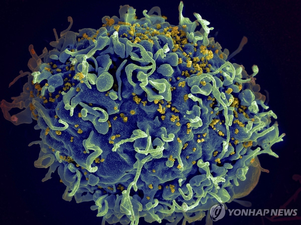 HIV에 공격받는 인간 T세포의 전자현미경 영상 캡처. /연합뉴스