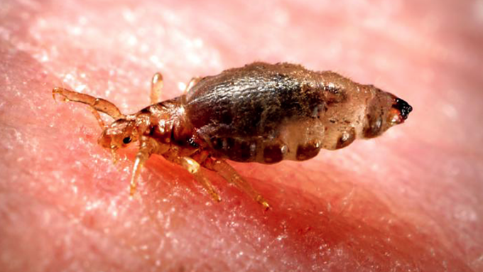 LA카운티 벼룩 매개 발진티푸스 감염 역대 최고 수준…주의 당부